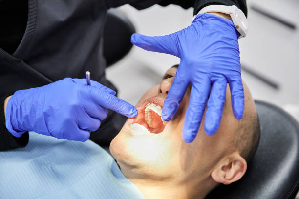 Best Emergency Dental Surgery in Ann Arbor, MI